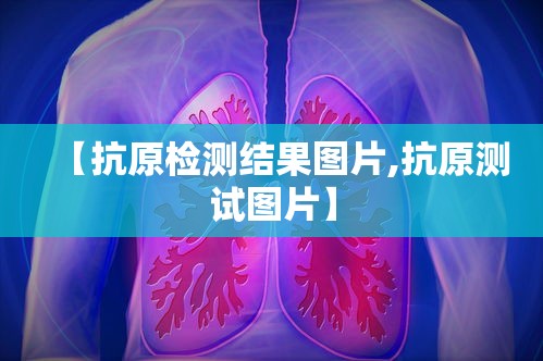 【抗原检测结果图片,抗原测试图片】 【抗原检测结果图片,抗原测试图片】